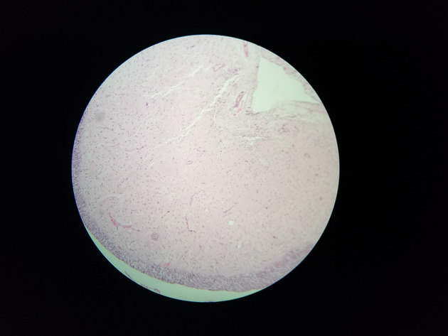 Pituitary Gland Slides - Pituitary Gland 005 100X